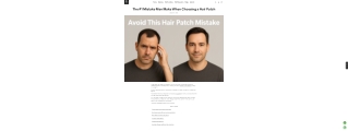 The #1 Mistake Men Make When Choosing a Hair Patch