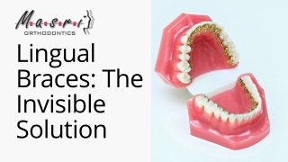 What Are Lingual Braces
