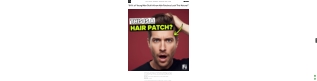 “90% of Young Men Didn’t Know Hair Patches Look This Natural”