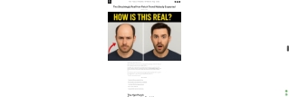 The Shockingly Real Hair Patch Trend Nobody Expected