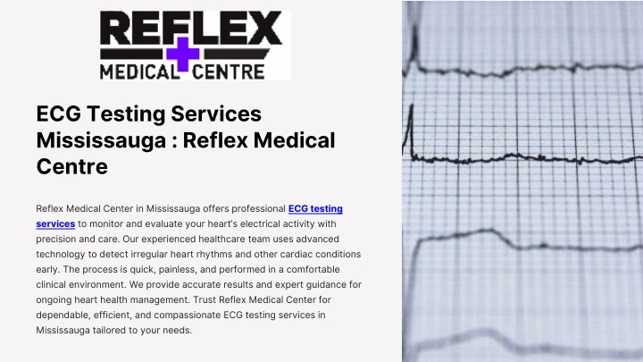 PPT - ECG Testing Services Mississauga Reflex Medical Centre (1 ...