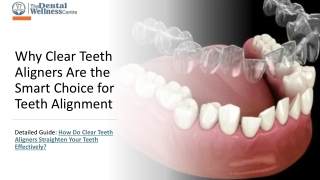 How Do Clear Teeth Aligners Straighten Your Teeth Effectively?
