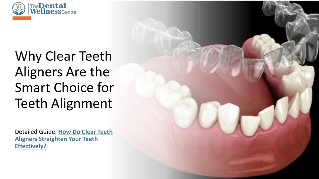 PPT - How Do Clear Teeth Aligners Straighten Your Teeth Effectively ...