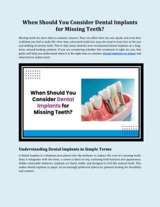 When Should You Consider Dental Implants for Missing Teeth