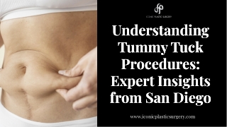 Understanding Tummy Tuck Procedures Expert Insights from San Diego