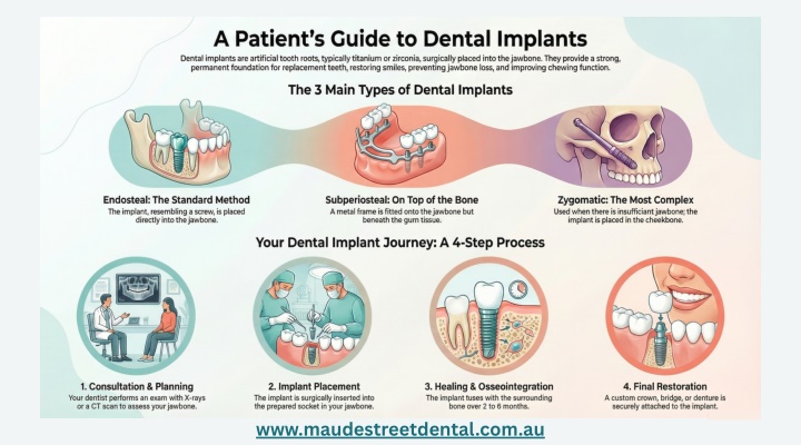 PPT - A Patient's Guide to Dental Implants PowerPoint Presentation ...