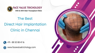 Best-Hair-Transplant-Clinic-in-Chennai