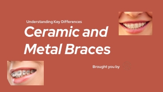 What Are The Differences Between Ceramic And Metal Braces?