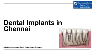 Dental Implants in Chennai - Dr. Amarnathan Dental Care