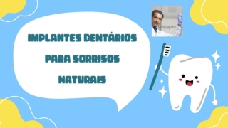 Implantes dentários para sorrisos naturais