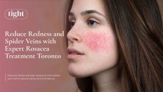 Find All Information About Rosacea Laser Treatment Toronto