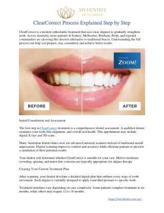 ClearCorrect Process Explained Step by Step