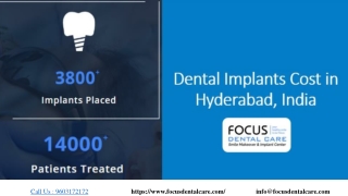 Dental Implants Cost in Hyderabad, India