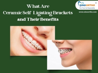 What Are Ceramic Self-Ligating Brackets and Their Benefits