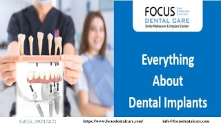 Complete Information on Dental Implants | Focus Dental Care