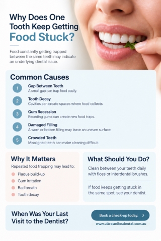 Why Does Food Keep Getting Stuck Between the Same Teeth?