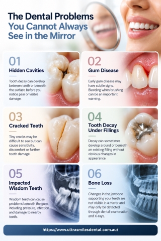 The Dental Problems You Cannot Always See in the Mirror